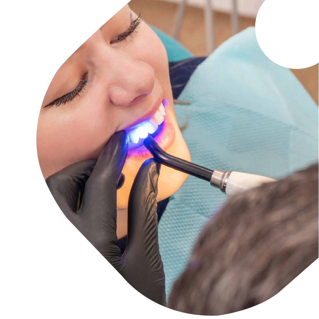 pyrenees-orthodontie-chirurgien-dentiste-appareil-dentaire-cabestany-66-bague-adulte-enfant-aligneur